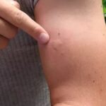 sivrisineklerde virus alarmi 10 kisiden biri oluyor WQThyjl6