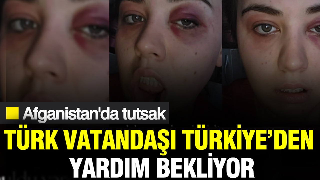 Cansu Badur’un Türkiye’den Yardım Çağrısı, Afganistan’daki Korkunç Durumunu Ortaya Koydu